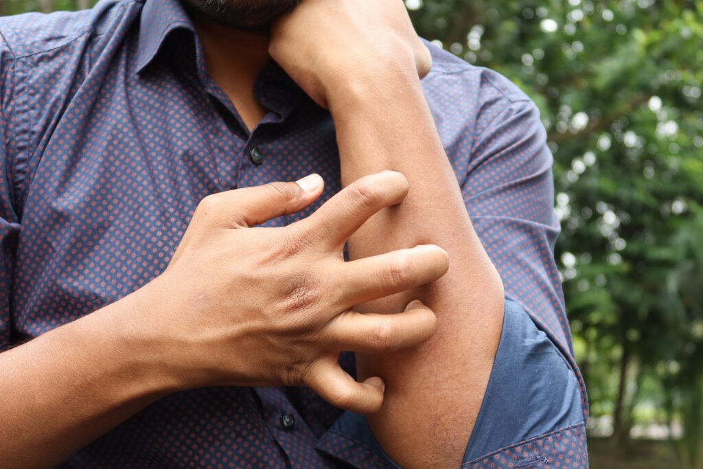 Limpeza de estofados e dermatite: entenda a relação