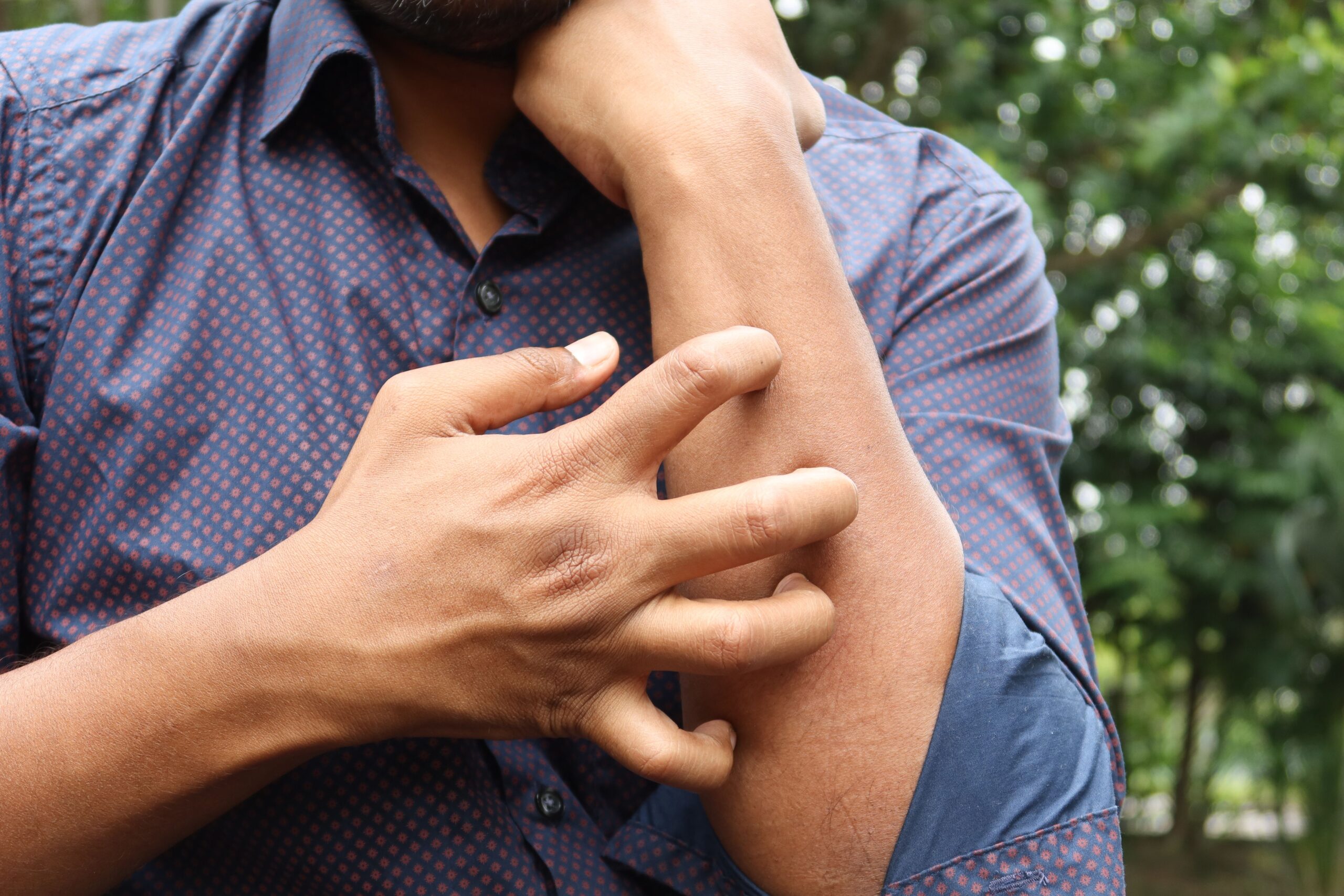Limpeza de estofados e dermatite: entenda a relação